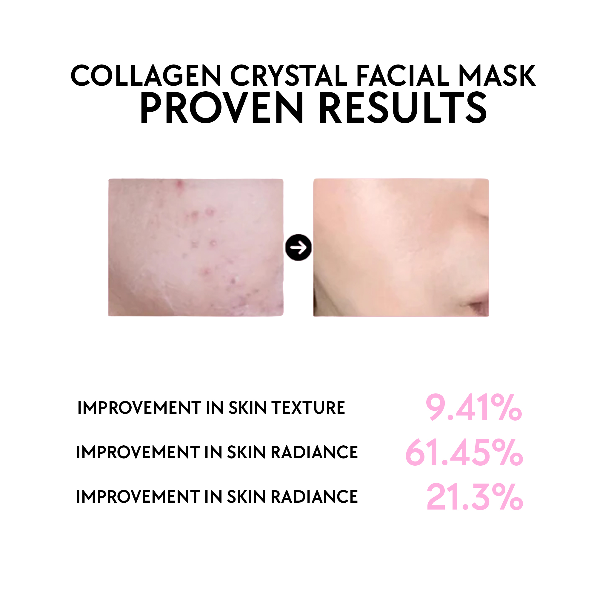 Anti Anging Facial Mask